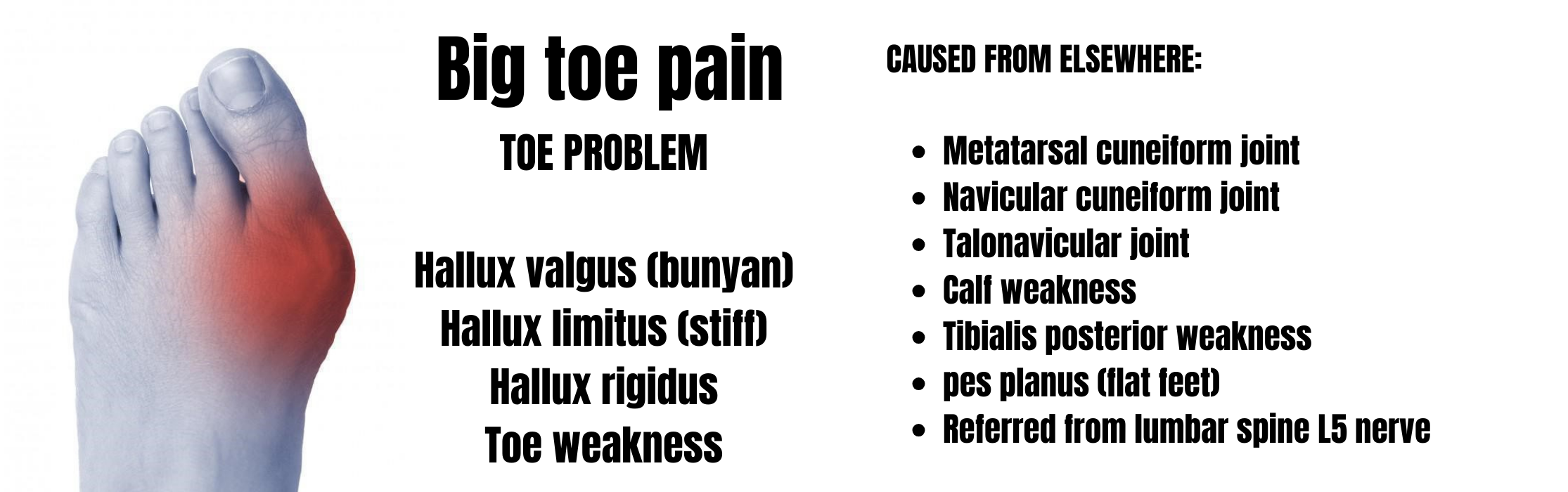 Big toe pain possible causes