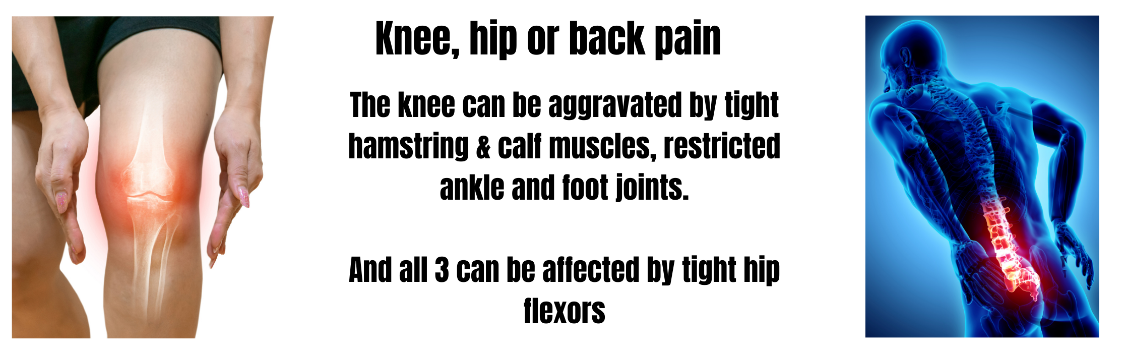 Knee, hip or back pain aggravated by the foot & ankleure
